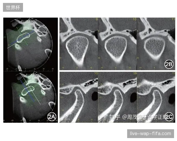 为何赛事多媒体分发网络接入医疗图像成为行业共识
